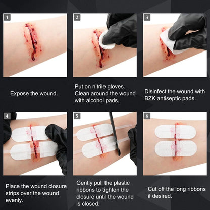 Wound Closure Kit (10-teilig)